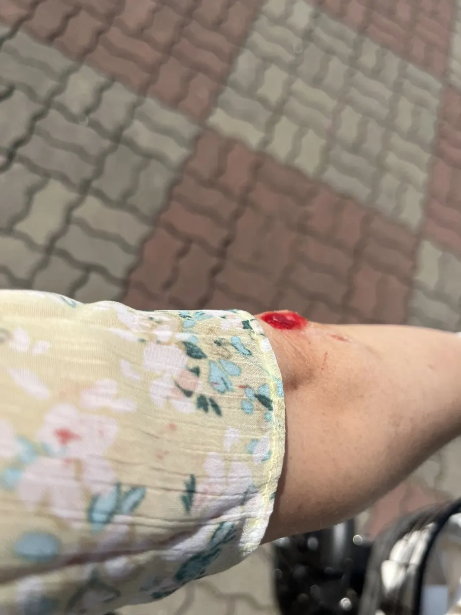 KakaoTalk_20250612_202233376_13.jpg?type=w1