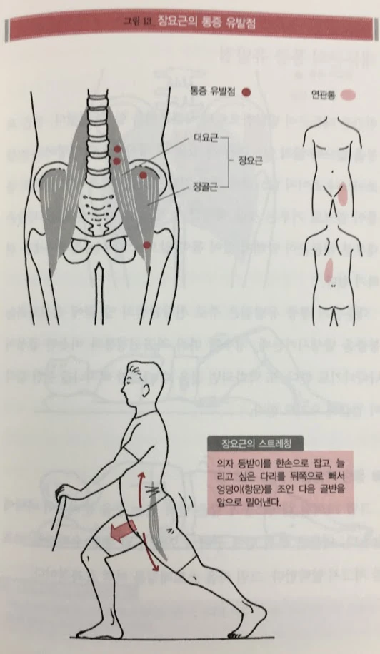 장요근통증유발점.JPG