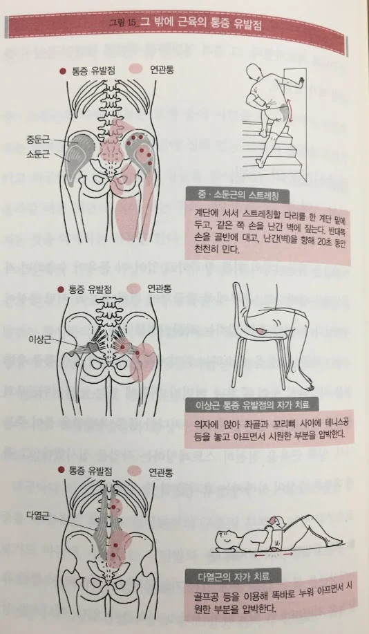 그 밖의 통증유발점.JPG