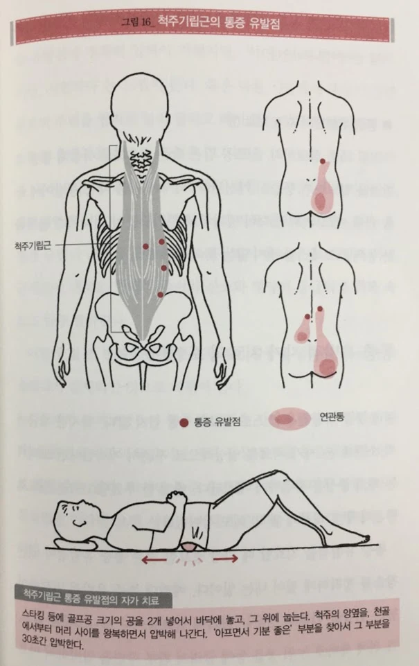 척추기립근 통증유발점.JPG
