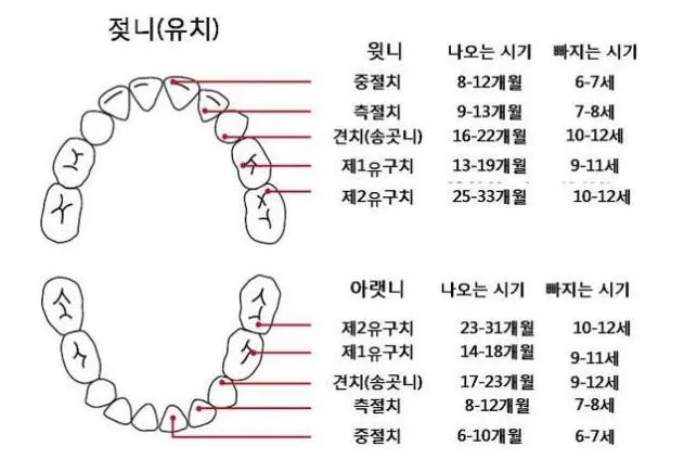 유치 나고 빠지는.JPG