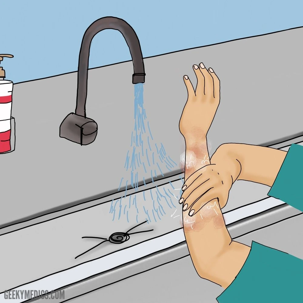 Hand-scrub-forearm-wash.jpeg