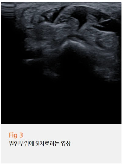 %EA%B7%B8%EB%A6%BC11.png?type=w966