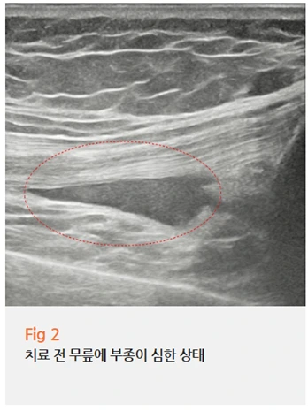 %EA%B7%B8%EB%A6%BC10.png?type=w966