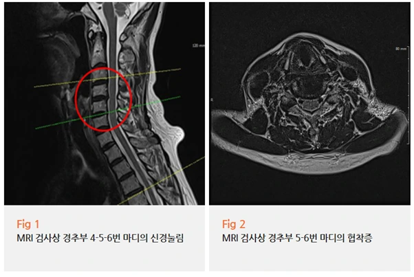 %EA%B7%B8%EB%A6%BC3.png?type=w966