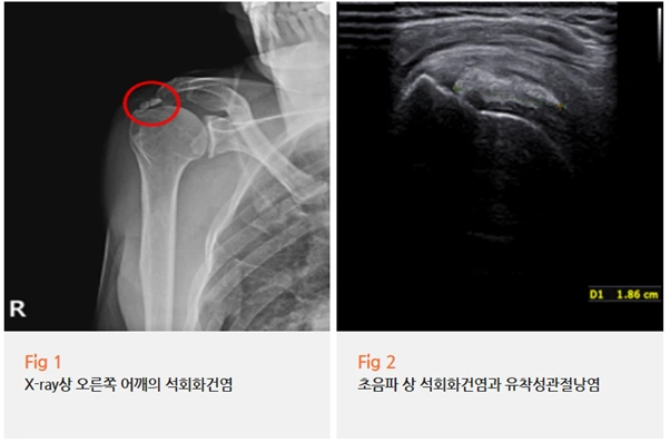 %EA%B7%B8%EB%A6%BC2.png?type=w966