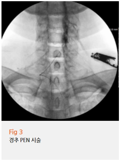 %EA%B7%B8%EB%A6%BC11.png?type=w966