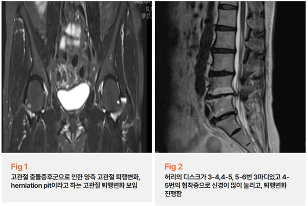 %EA%B7%B8%EB%A6%BC2.png?type=w966
