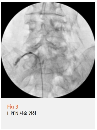 %EA%B7%B8%EB%A6%BC4.png?type=w966