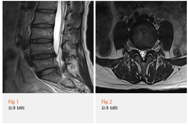 %EA%B7%B8%EB%A6%BC2.png?type=w966