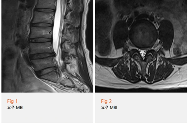 %EA%B7%B8%EB%A6%BC2.png?type=w966