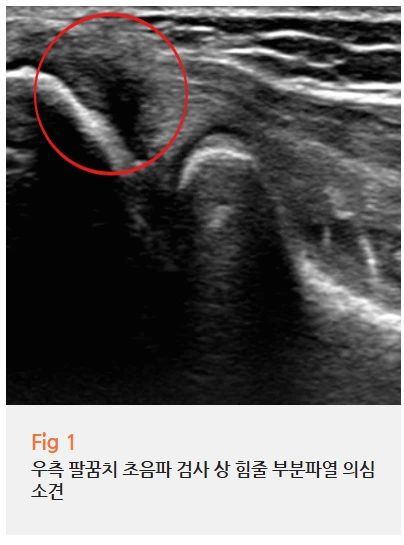 %EA%B7%B8%EB%A6%BC2.png?type=w966