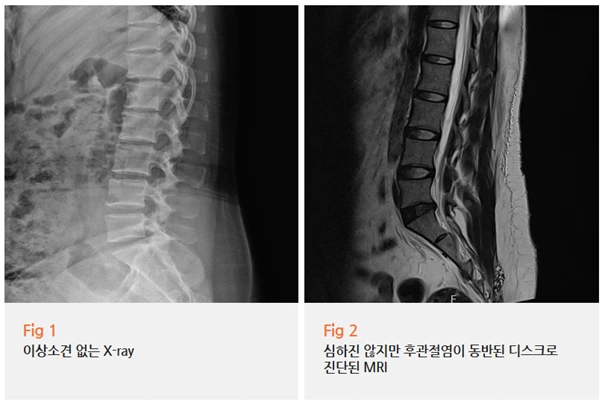 %EA%B7%B8%EB%A6%BC9.png?type=w966