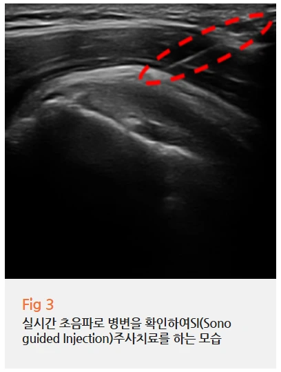 %EA%B7%B8%EB%A6%BC3.png?type=w966