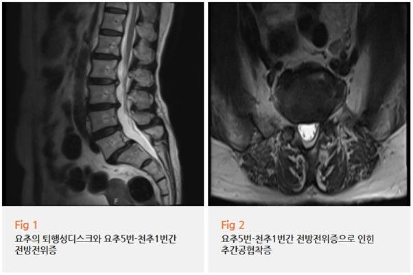 %EA%B7%B8%EB%A6%BC3.png?type=w966