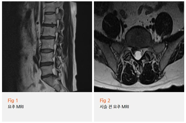 %EA%B7%B8%EB%A6%BC2.png?type=w966