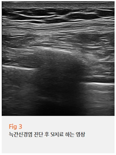 %EA%B7%B8%EB%A6%BC3.png?type=w966