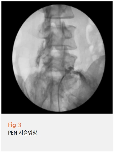 %EA%B7%B8%EB%A6%BC4.png?type=w966