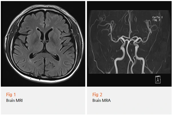 %EA%B7%B8%EB%A6%BC2.png?type=w966