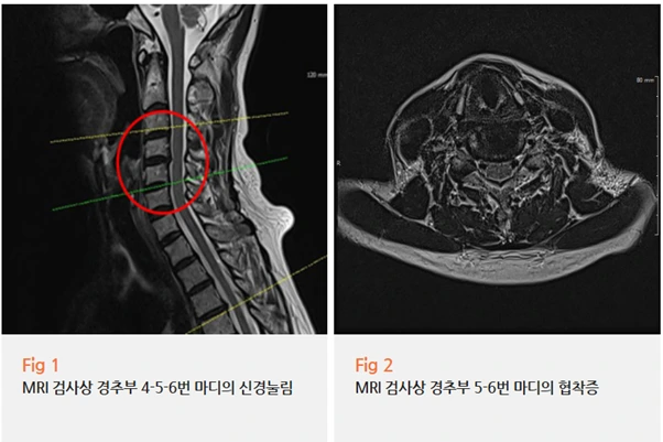 %EA%B7%B8%EB%A6%BC4.png?type=w966