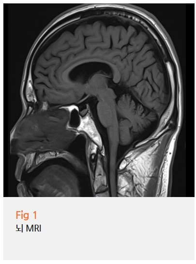 %EA%B7%B8%EB%A6%BC2.png?type=w966