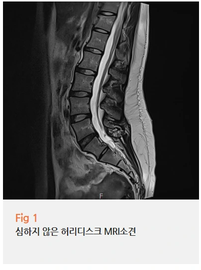 %EA%B7%B8%EB%A6%BC9.png?type=w966