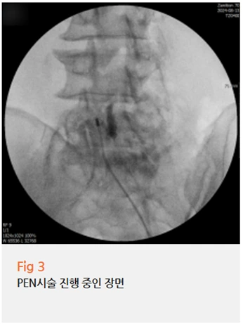 %EA%B7%B8%EB%A6%BC3.png?type=w966