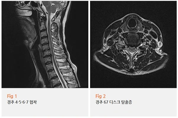 %EA%B7%B8%EB%A6%BC2.png?type=w966