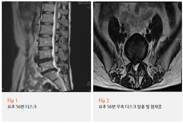 %EA%B7%B8%EB%A6%BC9.png?type=w966