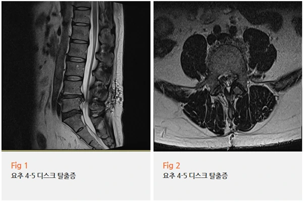 %EA%B7%B8%EB%A6%BC10.png?type=w966