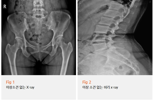 %EA%B7%B8%EB%A6%BC2.png?type=w966