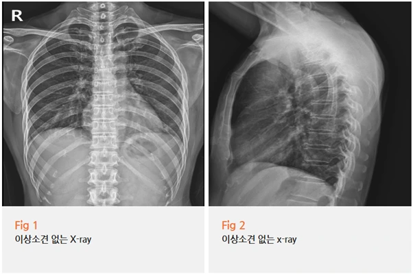 %EA%B7%B8%EB%A6%BC2.png?type=w966