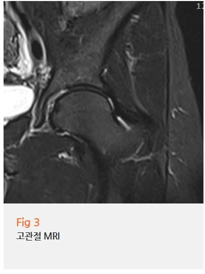 %EA%B7%B8%EB%A6%BC3.png?type=w966