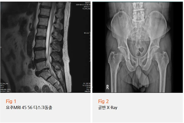 %EA%B7%B8%EB%A6%BC2.png?type=w966