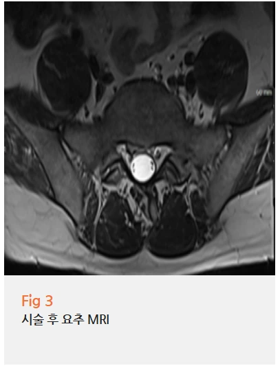 %EA%B7%B8%EB%A6%BC3.png?type=w966