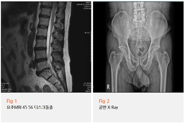 %EA%B7%B8%EB%A6%BC10.png?type=w966