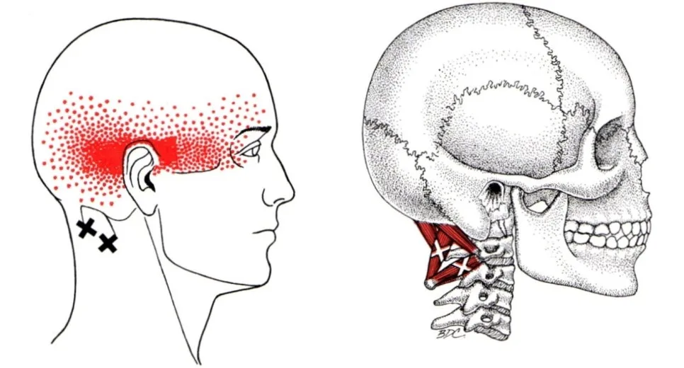 %EA%B7%B8%EB%A6%BC4.jpg?type=w966
