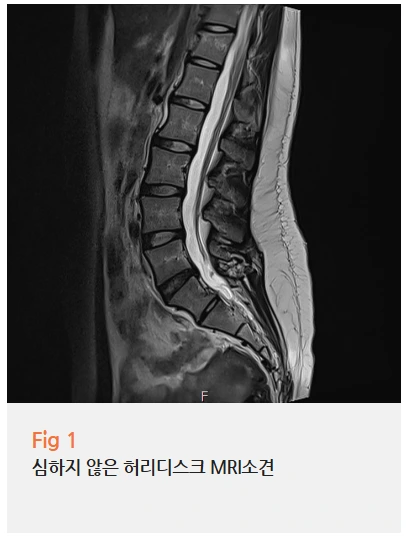 %EA%B7%B8%EB%A6%BC9.png?type=w966