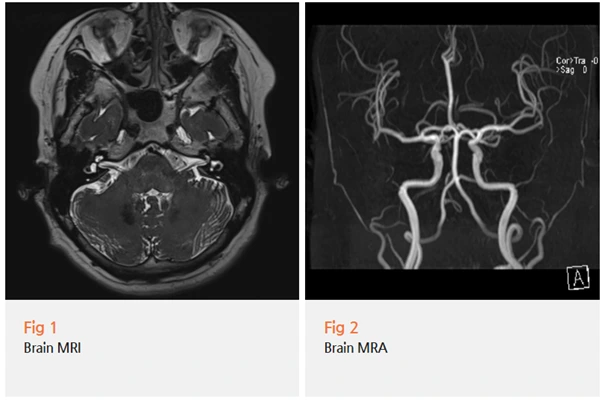 %EA%B7%B8%EB%A6%BC3.png?type=w966