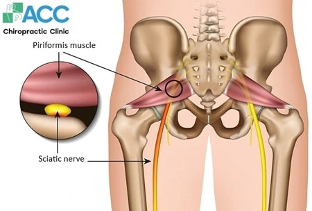 %EA%B7%B8%EB%A6%BC4.jpg?type=w966