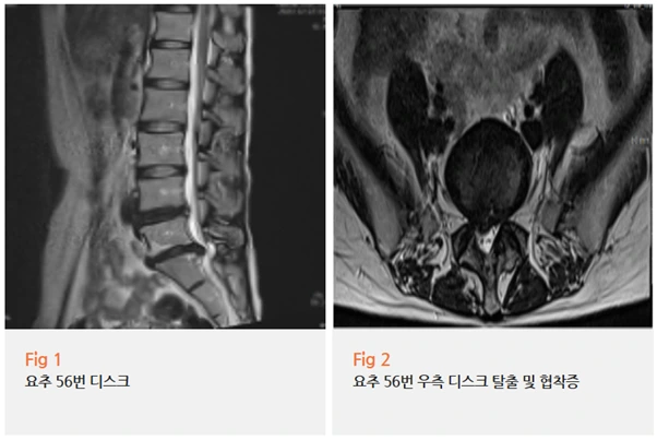 %EA%B7%B8%EB%A6%BC2.png?type=w966