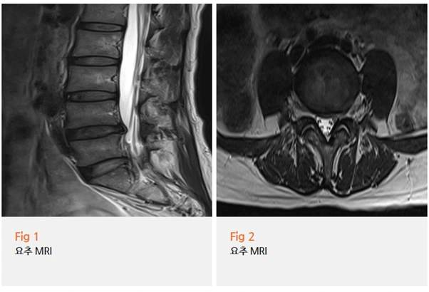 %EA%B7%B8%EB%A6%BC8.png?type=w966