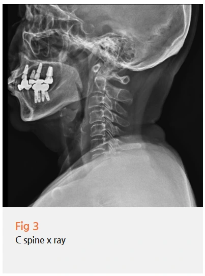 %EA%B7%B8%EB%A6%BC4.png?type=w966