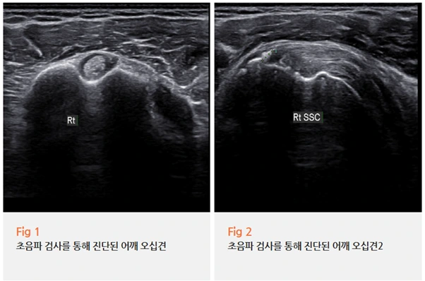 %EA%B7%B8%EB%A6%BC11.png?type=w966