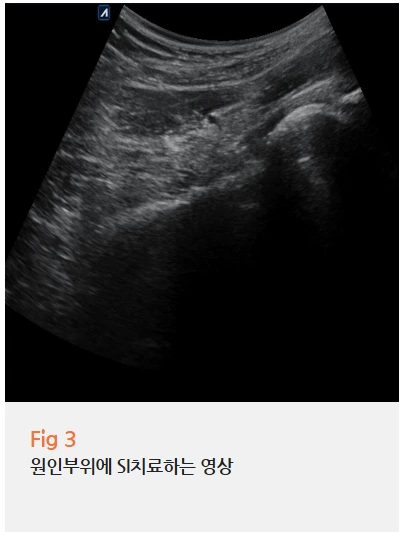 %EA%B7%B8%EB%A6%BC3.png?type=w966