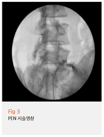 %EA%B7%B8%EB%A6%BC10.png?type=w966