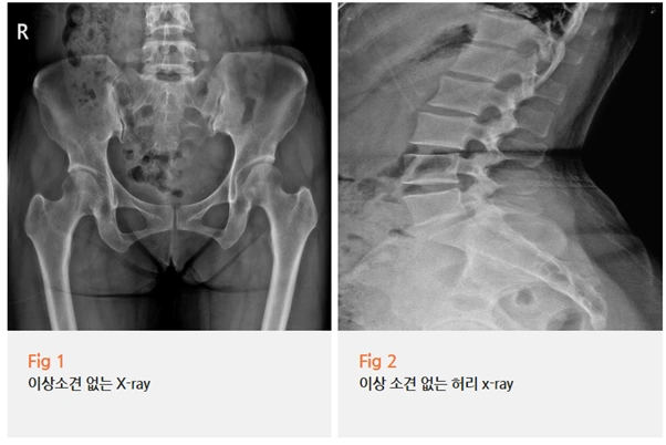 %EA%B7%B8%EB%A6%BC9.png?type=w966