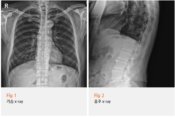 %EA%B7%B8%EB%A6%BC2.png?type=w966