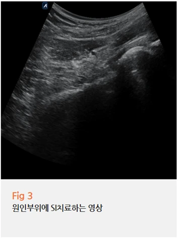 %EA%B7%B8%EB%A6%BC10.png?type=w966