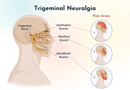 %EA%B7%B8%EB%A6%BC6.png?type=w966
